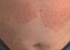 Baner