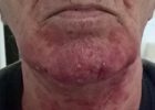 Baner