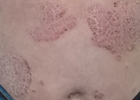 Baner