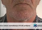 Baner