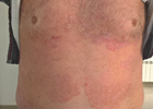 Baner
